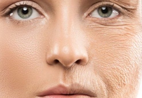 Mit igyunk a ránctalanítás érdekében?